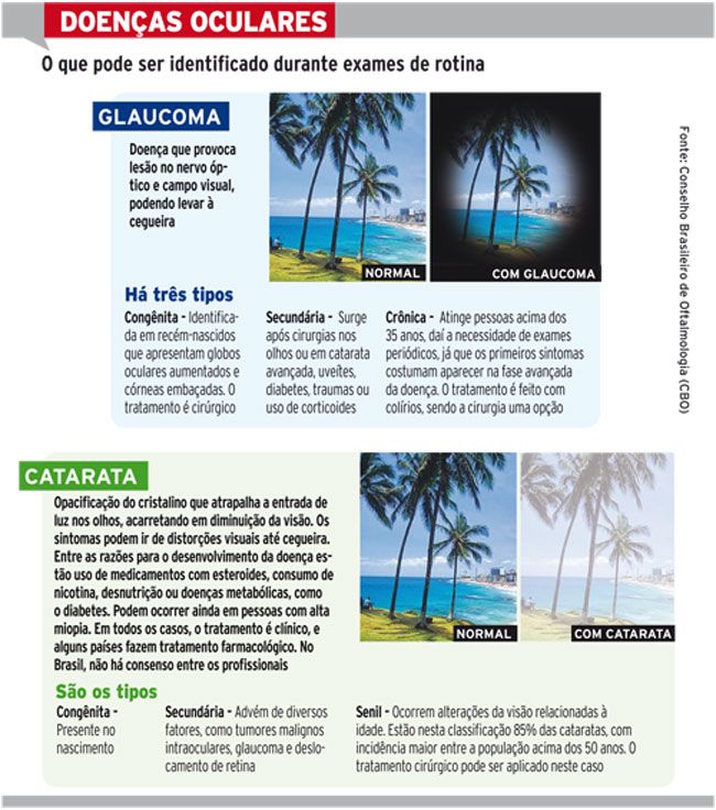 Ambulantes vendem óculos de grau no Centro 2 arte oculos