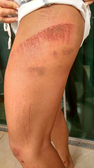 Polícia Civil prende ladrão que agrediu e arrastou vizinha por escada 1 Mulher foi arrastada por criminoso durante assalto (Foto: Divulgação/ Polícia Civil)