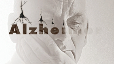 Dez (10) alimentos para prevenir Alzheimer 2 alzheimerpi