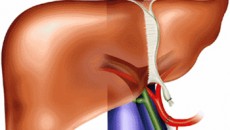 Saiba mais sobre Esteatose Hepática 2 Figado