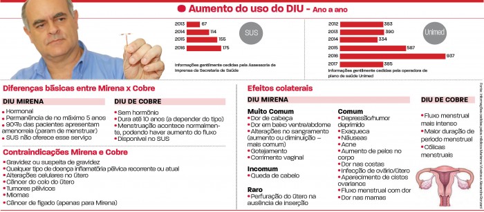 Mitos e verdades sobre o DIU 2 DIU