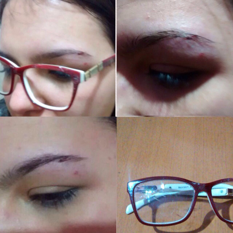 Humorista Gustavo Mendes é suspeito de agredir jovem de 19 anos 1 agressao fernanda bellotti