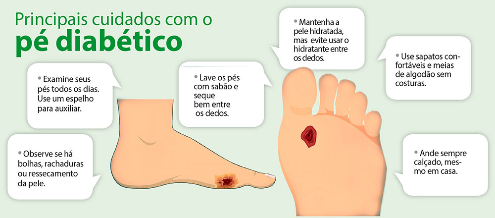 Tratamento do pé diabético, o que você precisa saber 2 arte pe diabetico