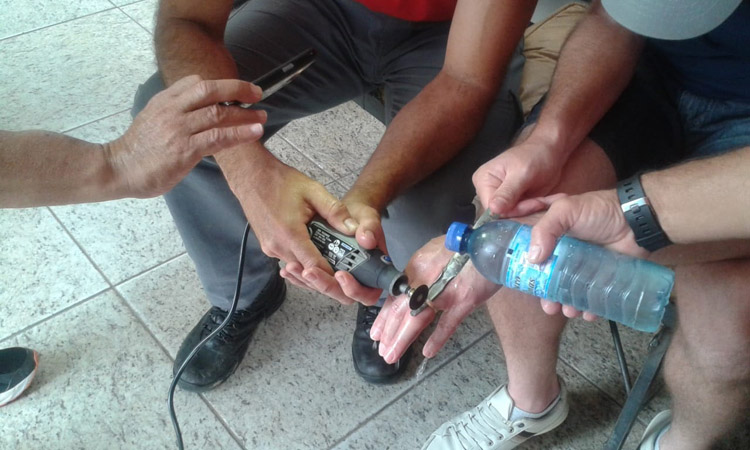 Homem prende anel em dedo e precisa de ajuda dos Bombeiros 1 dedo preso divulgação bombeiros