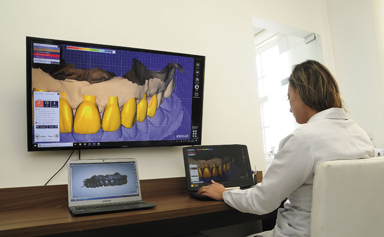 Odontologia digital: mais conforto na busca por um sorriso perfeito 4 doutor renan reboucas 3