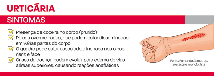 Juiz de Fora ganha Centro de Referência em Tratamento de Urticárias 2 Urticária