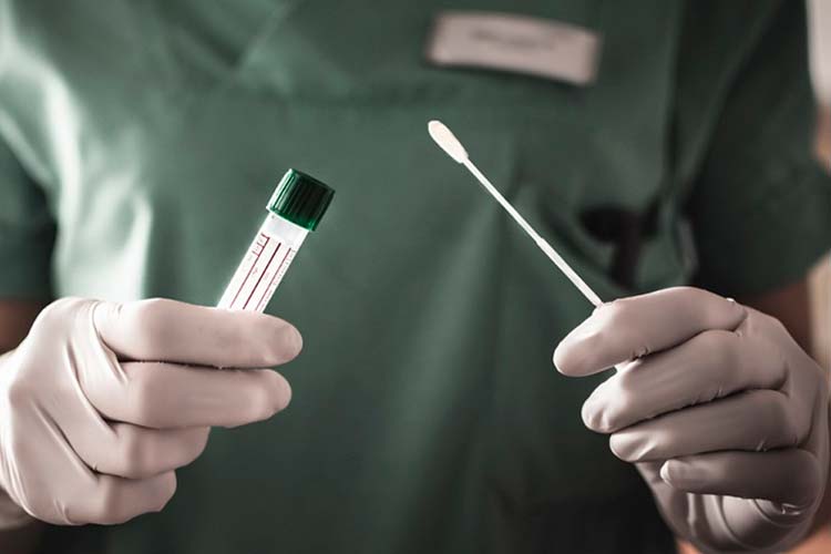 País registra mais 1.607 mortes pela Covid-19 1 coronavirus by prefeitura de assis
