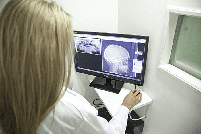 Saiba como escolher o melhor regime tributário no setor de saúde 2 x ray of the jaw 2416943 1920 EDITADA 1