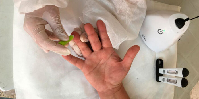 SESI disponibiliza testes rápidos para a detecção da Covid-19 1 destacada 12