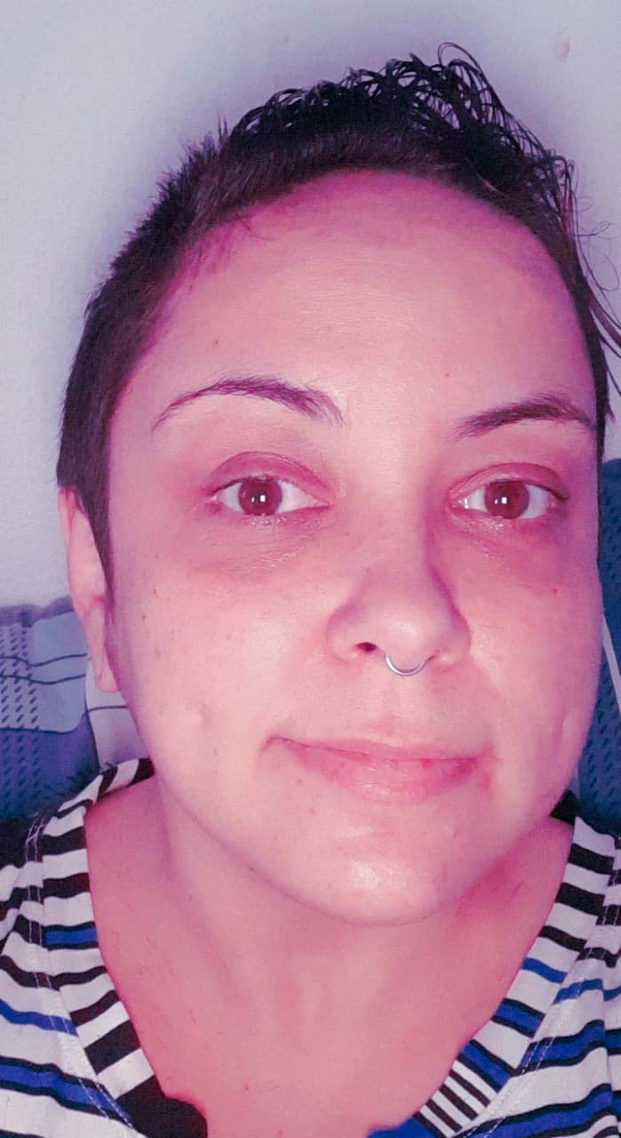Coragem e esperança marcam histórias de mulheres na luta contra o câncer 1 2 Daiane paciente câncer de mama