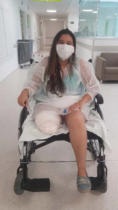 Estudante de Engenharia Elétrica faz vaquinha virtual para comprar prótese 1 Samara