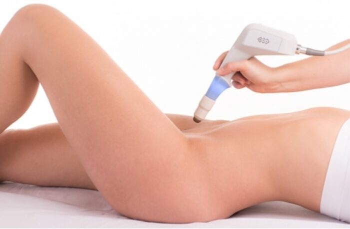 tratamento intimo feminino