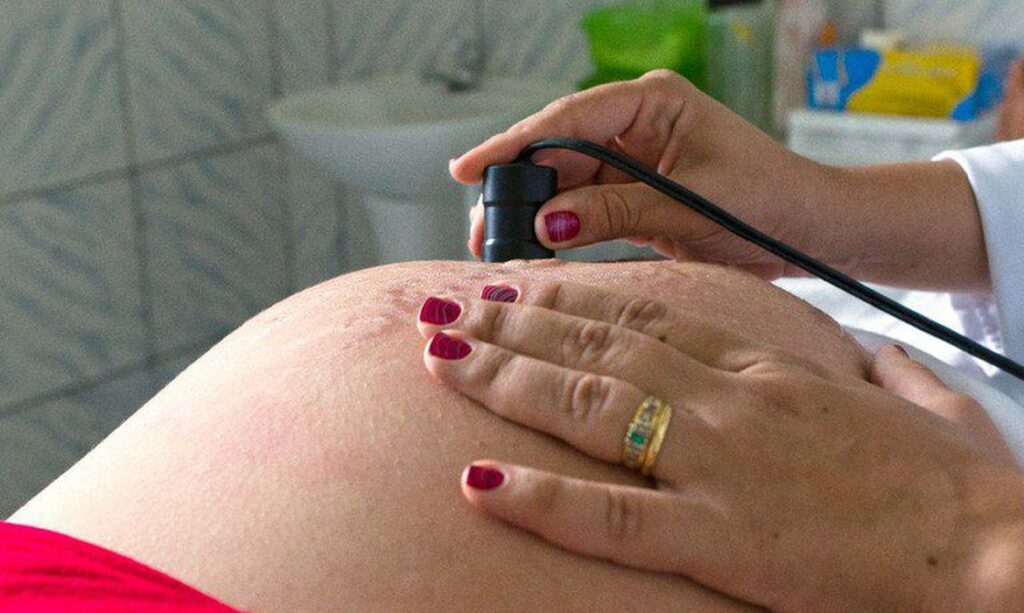 Mulheres relembram episódios de violência obstétrica em Juiz de Fora 3 gestante