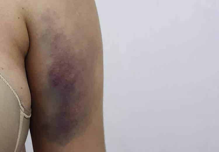 Militar suspeito de agredir ex na frente da filha será ouvido pela polícia 1 Mulher agredida 6