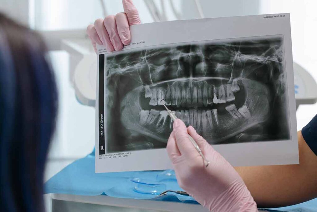 Clínica deve indenizar paciente após erro em implante de prótese dentária 1 dentista radiografia pexels