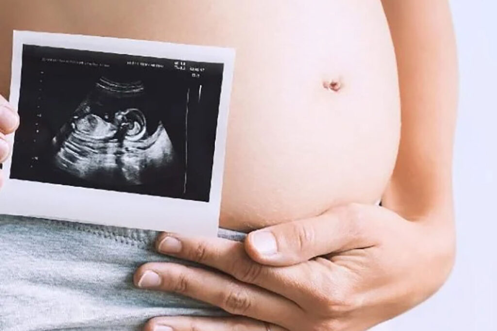 Mielomeningocele: cirurgia dentro do útero possibilita que crianças consigam andar 3 mulher gravida ultrassom Mielomeningocele foto minha vida