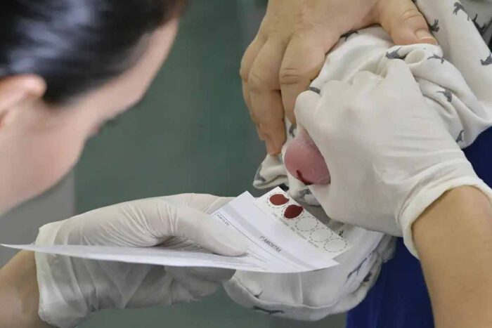 Reino Unido autoriza a realização de terapia gênica inédita para pessoas com anemia falciforme 1 Teste do pezinho Edilson Rodrigues Agencia Senado