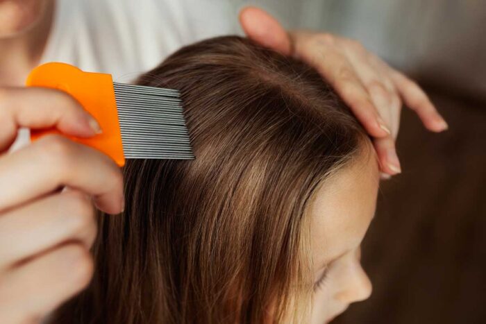 Piolhos: saiba os mitos e as verdades e como proteger seus filhos 1 mae cuidando crianca piolhos freepik