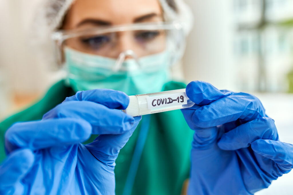 Moradores de Juiz de Fora podem participar de pesquisa para avaliar sequelas da Covid-19 1 closeup epidemiologist with covid19 sample test tube