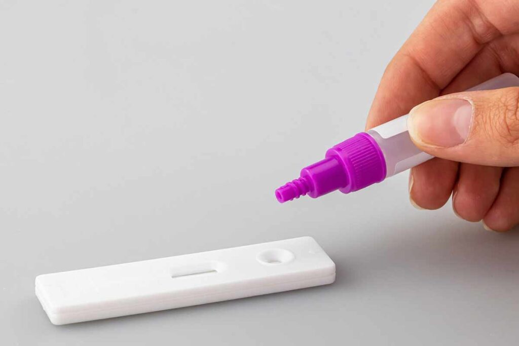 Farmácias poderão realizar testes rápidos de HIV e sífilis 1 teste rapido pixabay