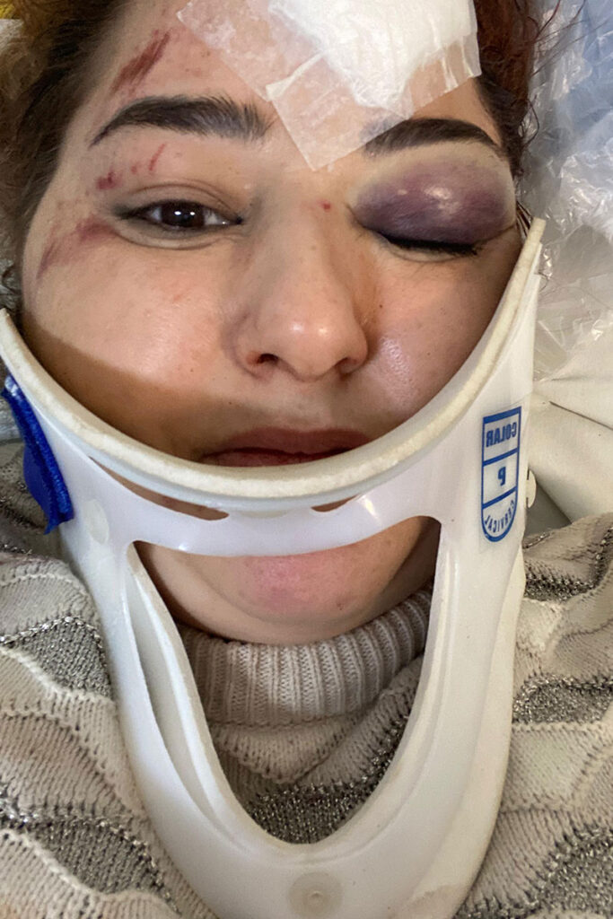 “Médico perguntou se eu acreditava em Deus”, conta mulher arremessada de brinquedo em Além Paraíba 1 “Médico perguntou se eu acreditava em Deus”, conta mulher arremessada de brinquedo em Além Paraíba