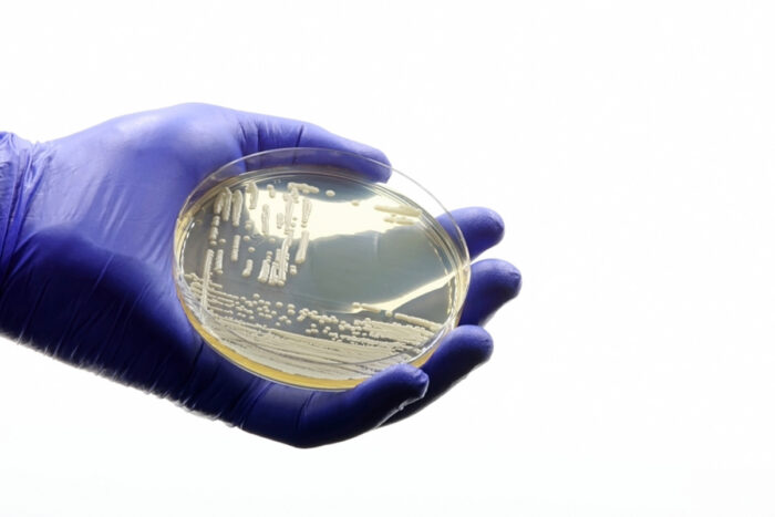 Candida auris: Estado investiga 5 casos de infecção pelo fungo 1 Candida auris: Estado investiga cinco casos de infecção pelo fungo