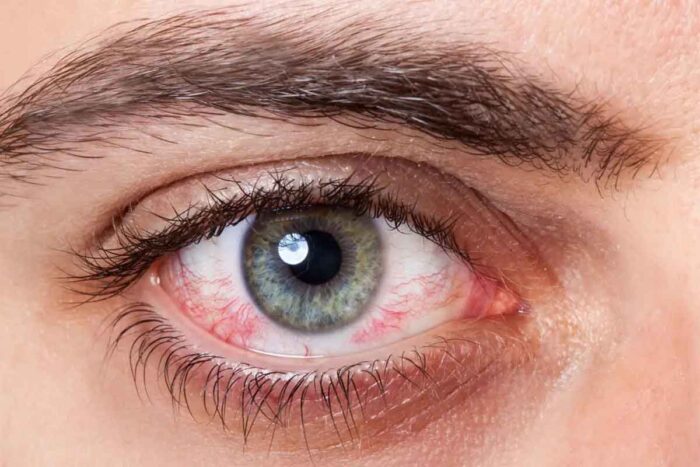 Tratamento com células-tronco reverte cegueira em pessoas com danos graves nos olhos 1 celulas tronco tratamento cegueira cornea foto reproducao
