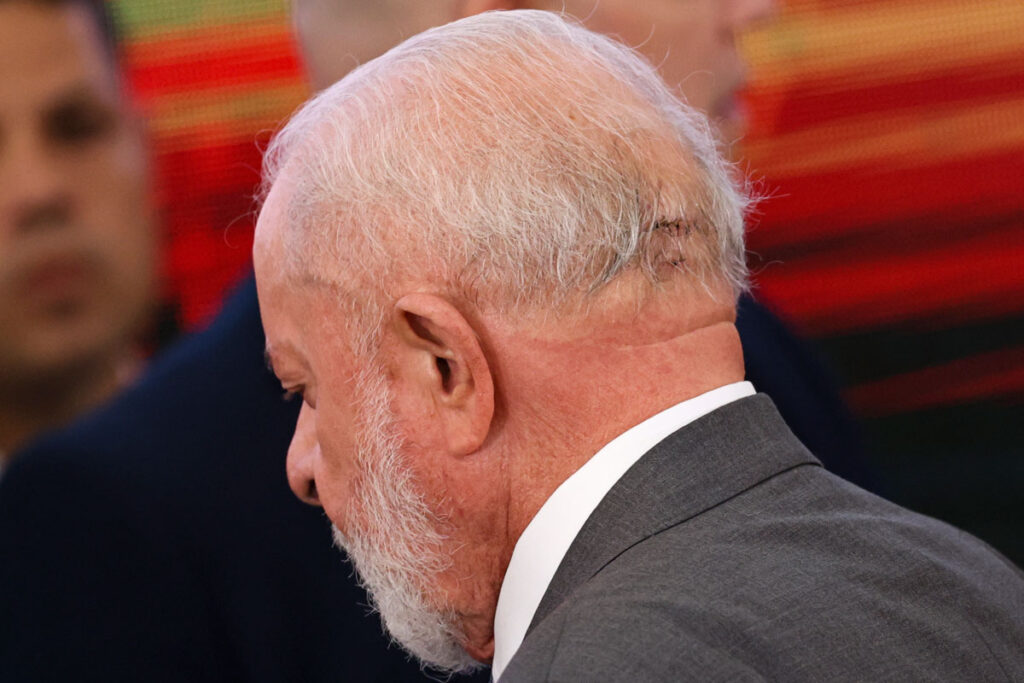 Procedimento "foi um sucesso" e presidente Lula já está conversando 3 lula novo procedimento