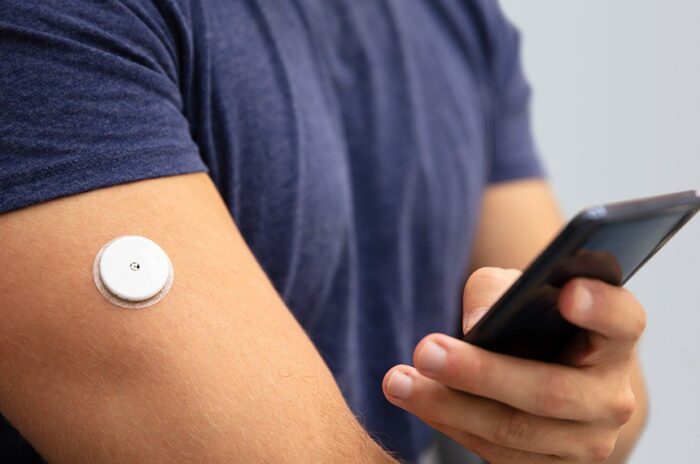 Câmara aprova distribuição de sensor digital de glicose a pessoas com diabetes 1 imagem materia