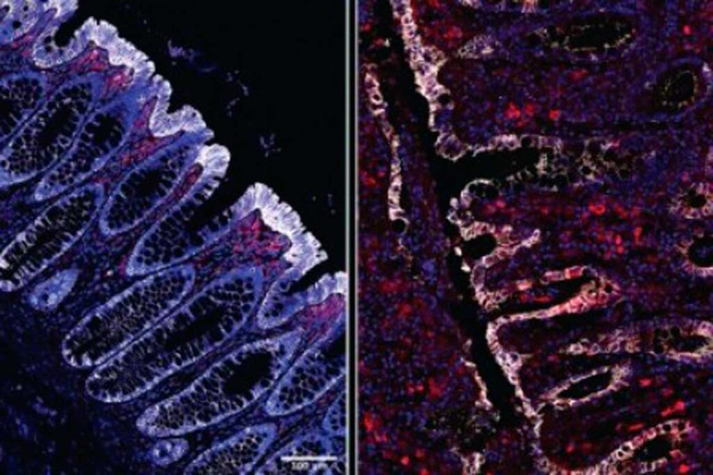 Fibras protegem intestino contra infecção bacteriana grave, sugere estudo 2 Fibras protegem intestino contra infeccao bacteriana grave foto agencia fapesp dest