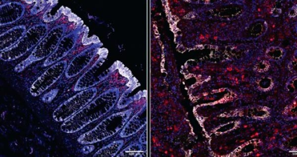 Fibras protegem intestino contra infecção bacteriana grave, sugere estudo 1 Fibras protegem intestino contra infeccao bacteriana grave foto arquivo pesquisadores