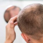 Ozempic pode causar queda de cabelo e queimação na pele, alertam dermatologistas