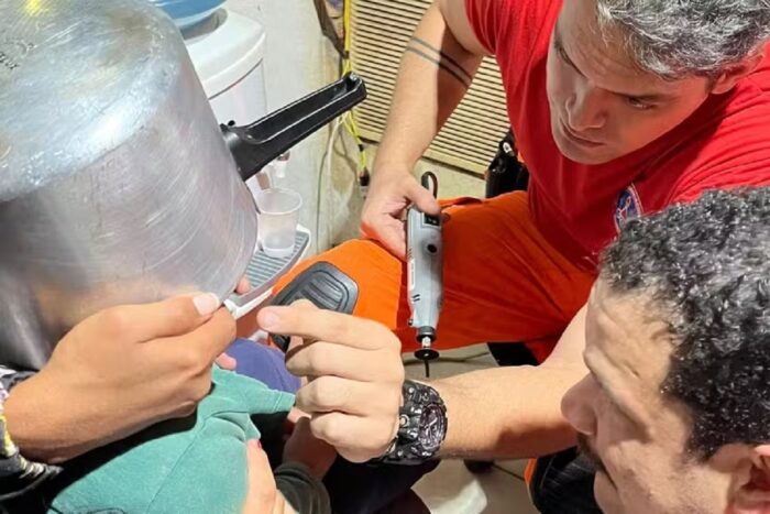 Criança de 2 anos é socorrida com panela de pressão presa na cabeça em Minas