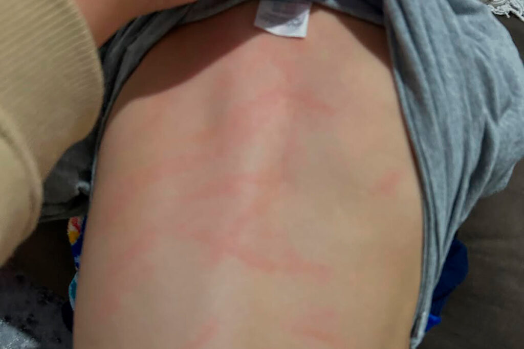 Denúncia de agressão a criança em creche de JF: intimados serão ouvidos nesta quinta 1 Denúncia de agressão a criança em creche de Juiz de Fora: envolvidos serão ouvidos nesta quinta-feira pela Polícia