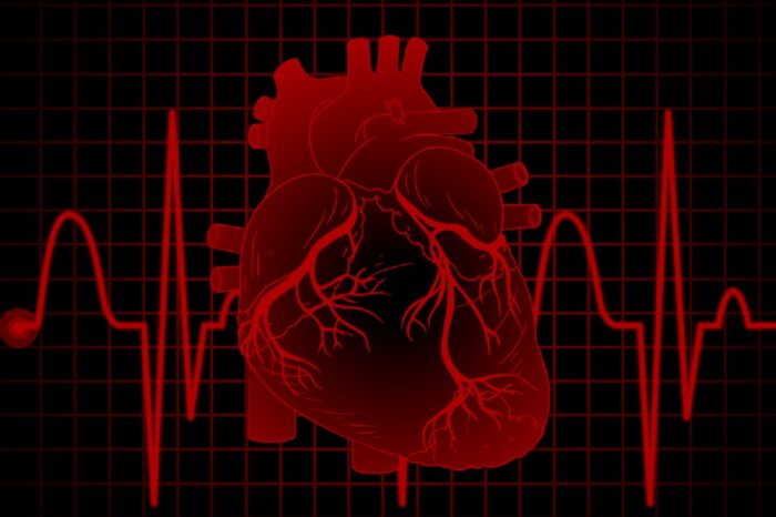 Estudo aponta que variações dos níveis de glicose podem indicar gravidade de dano após infarto 1 Estudo aponta que variações dos níveis de glicose podem indicar gravidade de dano após infarto