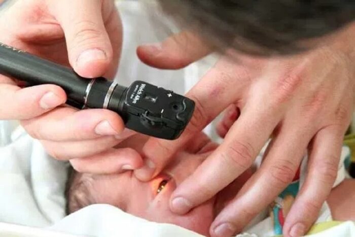 Teste do olhinho deve ser repetido três vezes por ano até os 3 anos 1 teste do olhinho