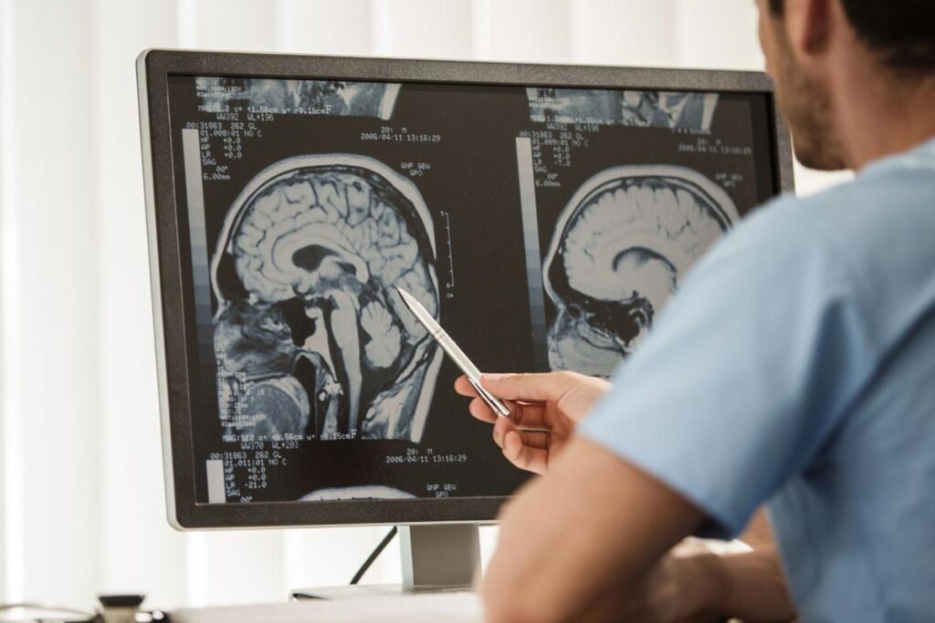 Vorasidenibe: entenda as promessas do medicamento recém-aprovado para câncer cerebral 1 Vorasidenibe: entenda as promessas do medicamento recém-aprovado para câncer cerebral