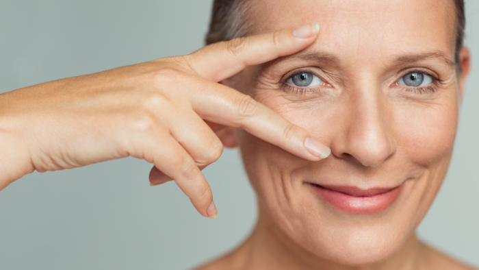 blefaroplastia resultado natural no olhar
