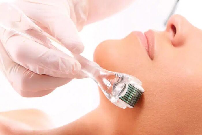 Clínica e esteticista são condenadas por resultado insatisfatório e uso de material irregular em procedimento estético 1 Clínica e esteticista são condenadas por resultado insatisfatório e uso de material irregular em procedimento estético