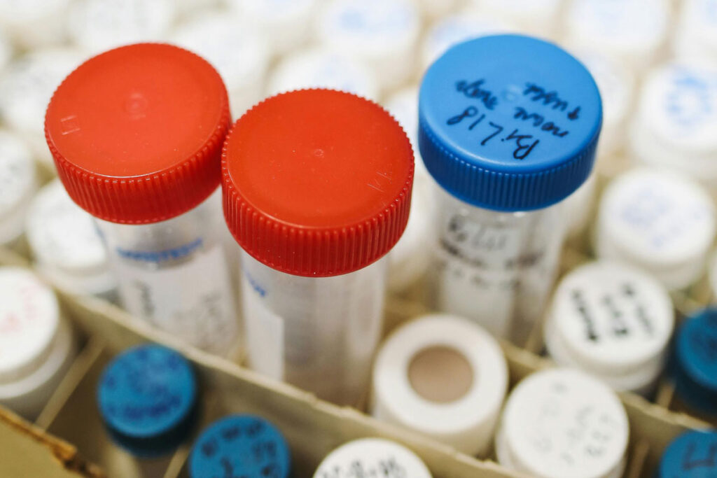 DNA exame pexels