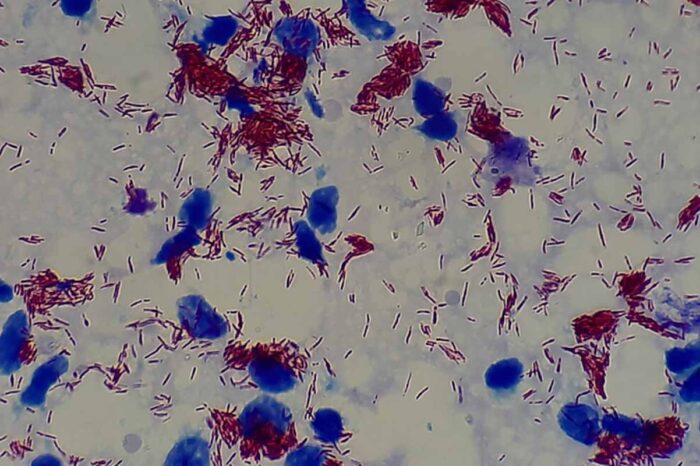 Hanseníase: exame de sangue