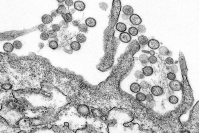 O que é o hantavírus, identificado em surto que causou mortes em cruzeiro holandês 2 hantavirus CDC Cynthia Goldsmith reproducao