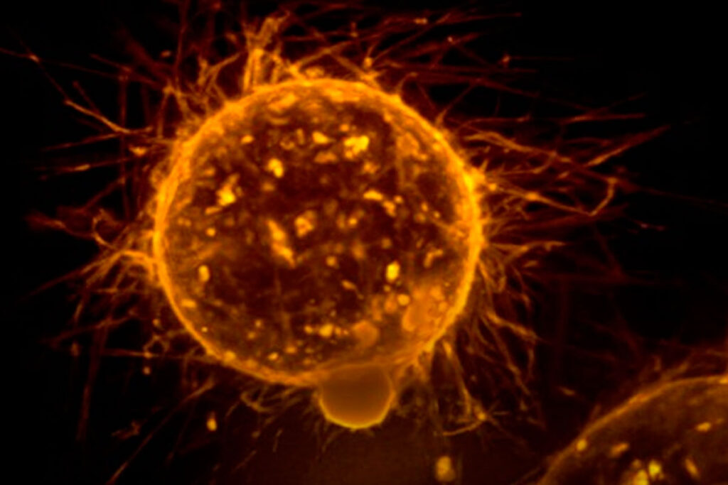 estudo cancer foto NCI Unsplash