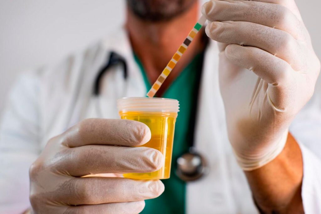 Raro, câncer de bexiga pode avançar rapidamente sem diagnóstico adequado 1 cancer bexiga foto pexels