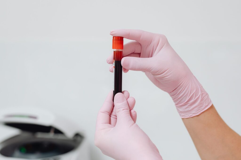 Exame feito com uma simples coleta de sangue chega ao Brasil e chama atenção por conseguir procurar sinais de mais de 50 tipos de câncer em uma única análise